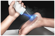 Why Choose Cryo-Master?